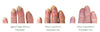 Polybalm – The Only Clinically Proven Nail Balm to Prevent & Repair Chemo Nail Damage | 100% Natural