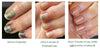 Polybalm – The Only Clinically Proven Nail Balm to Prevent & Repair Chemo Nail Damage | 100% Natural