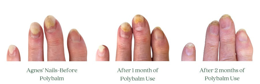 PolybalmUSA