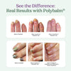 Polybalm – The Only Clinically Proven Nail Balm to Prevent & Repair Chemo Nail Damage | 100% Natural